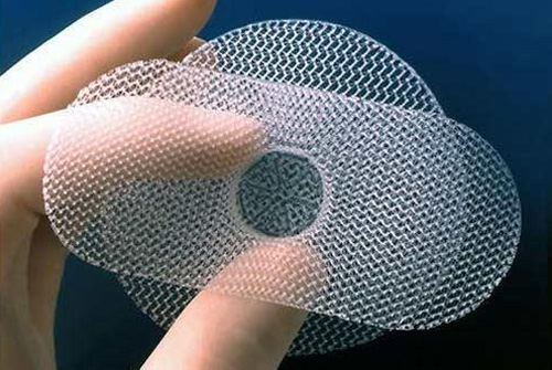 Aashirwad Agencies - Prolene Mesh